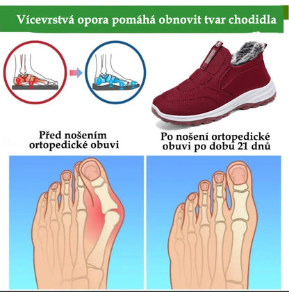 (🔥DNES SLEVA 50 % - NENECHTE SI UJÍT) ⏰ - Měkké a pohodlné zimní italské luxusní značkové semišové ortopedické boty (podpora - úleva od bolesti nohou)